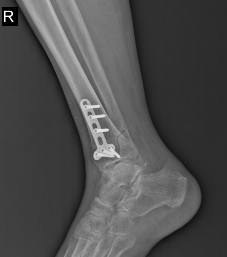 1726474062153752.png image.png