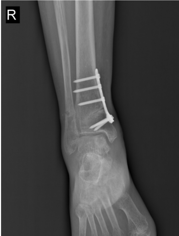 1726474071738611.png image.png